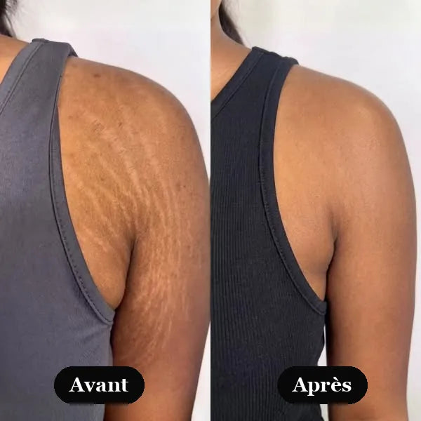 Épaule