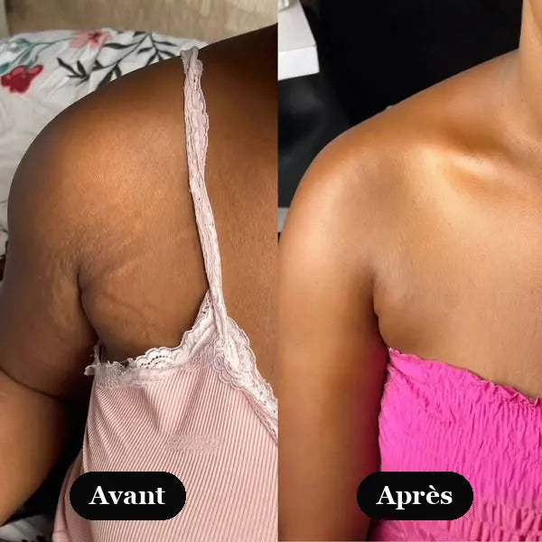 Bras